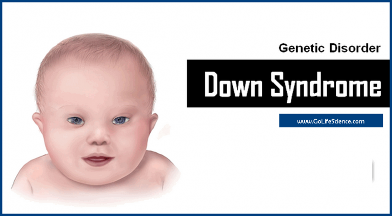 Down Syndrome: Genetic Disorder of Humans